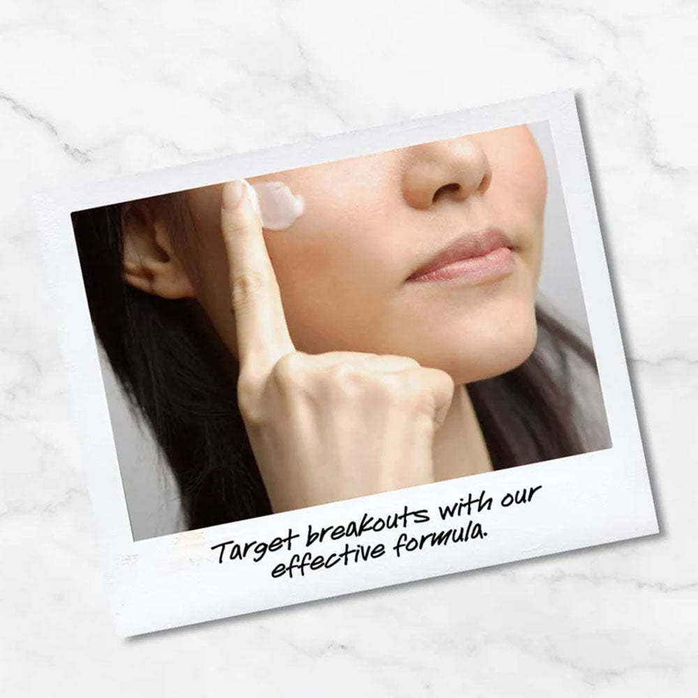 Kiehl's Breakout Control Targeted Blemish Spot Treatment 20ml