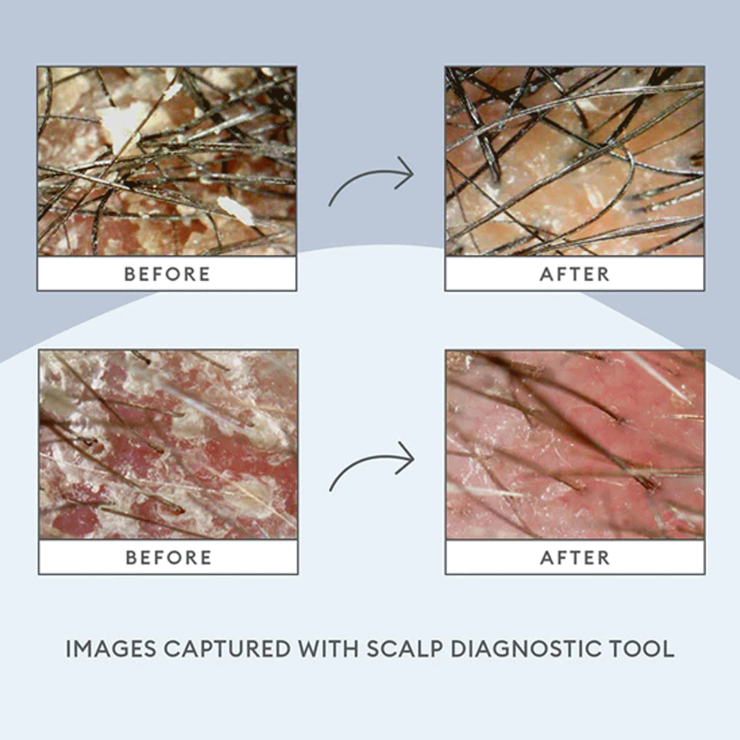 Briogeo Scalp Revival Soothe + Detoxify Travel Set