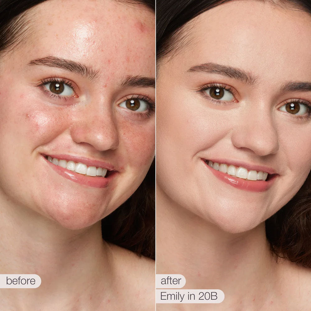 Tarte Shape Tape Contour Concealer 20B light  10ml