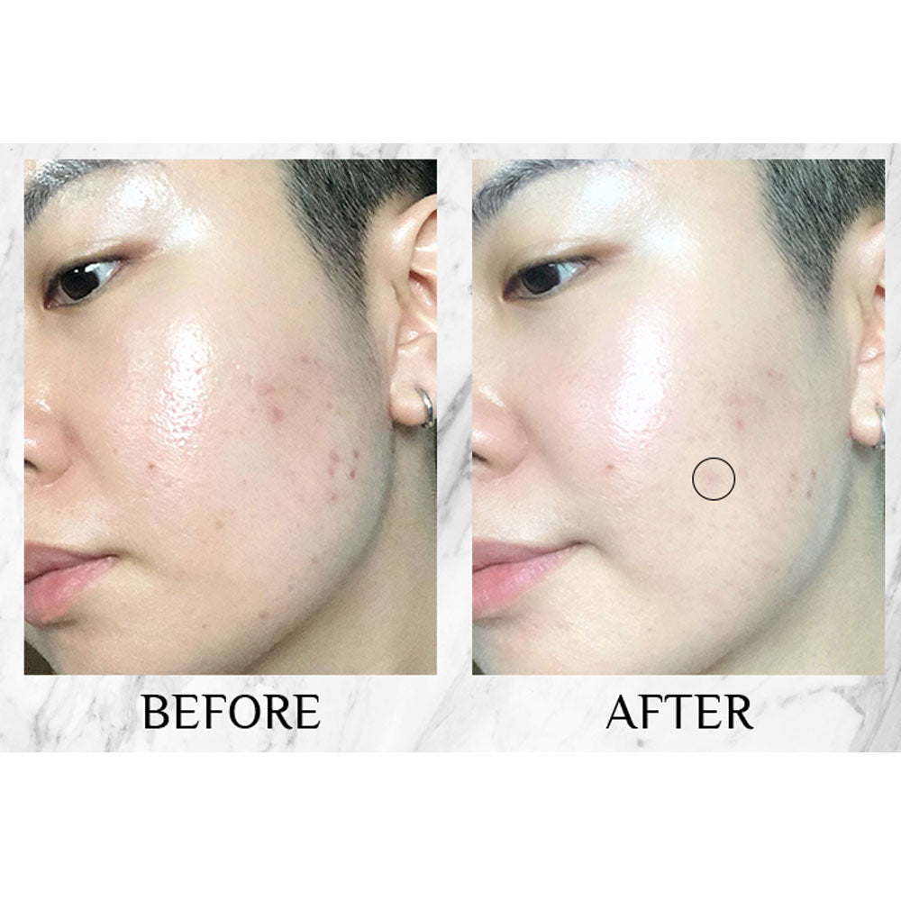 Clinique Even Better Clinical Dark Spot Corrector + Interrupter - 50ML