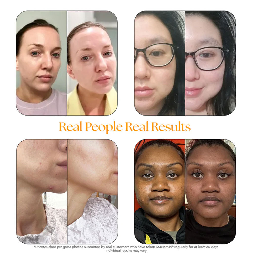 SKINtamin  Vitamin for Skin Health & Collagen Support - 30 Capsules