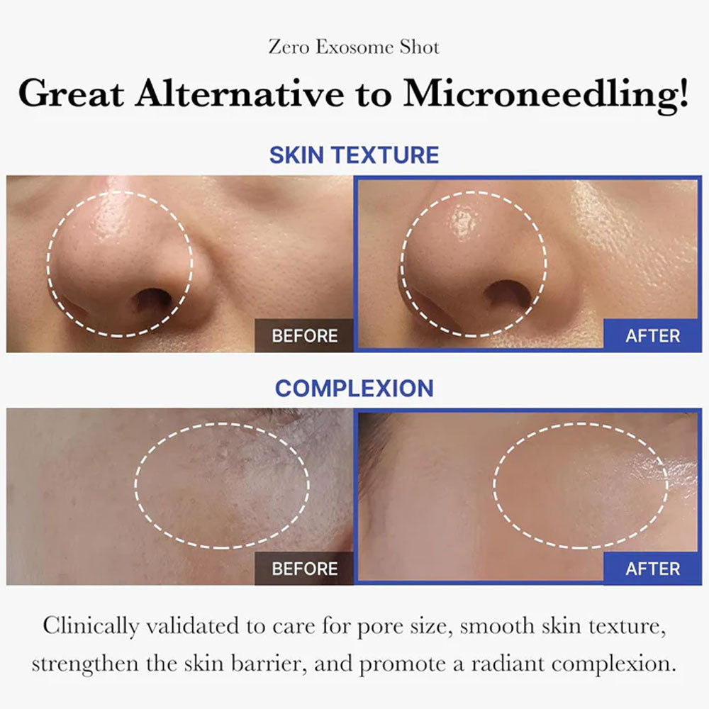 Medicube One-Day Exosome Shot Pore Ampoule 7500 - 30ml