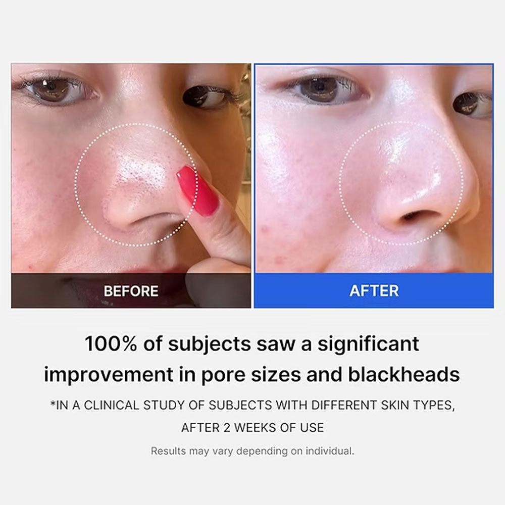 Medicube Zero Pore Pad Mild 70 Pads