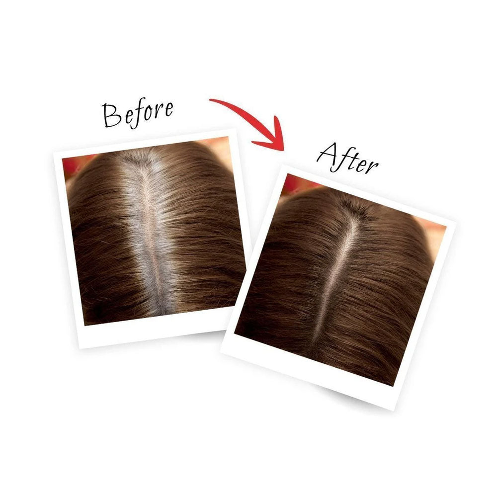 L'Oreal Magic Retouch Hair Color - Brown 75ml