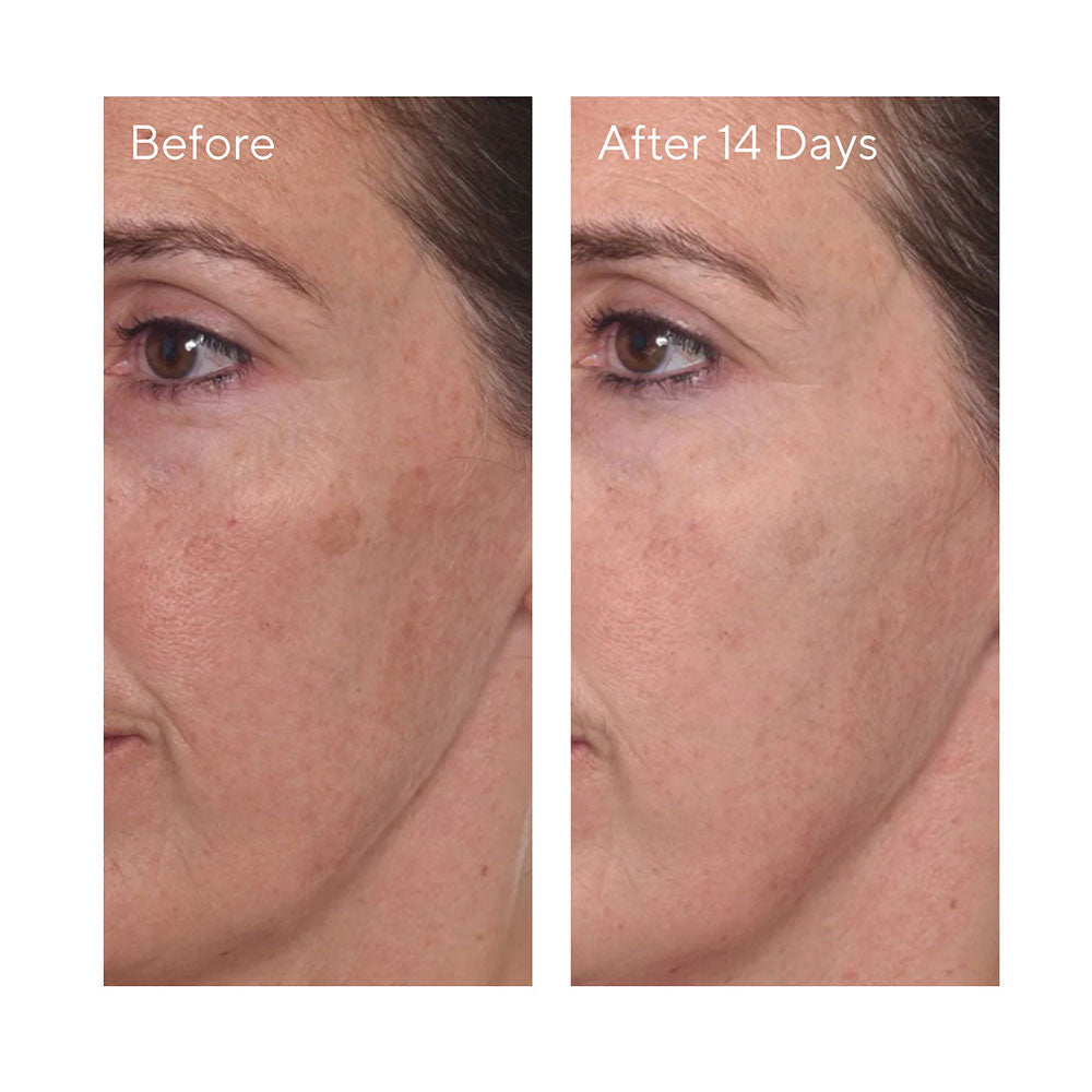 Clinique Even Better Clinical Dark Spot Corrector + Interrupter - 50ML