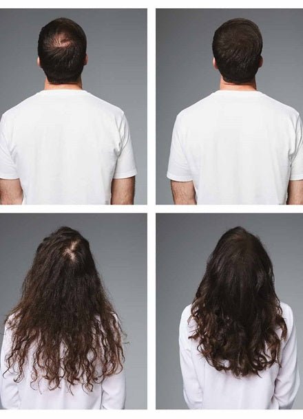 L'Oreal Professionnel Serioxyl Brown Thinning Hair Volumising Colored Spray 200ml