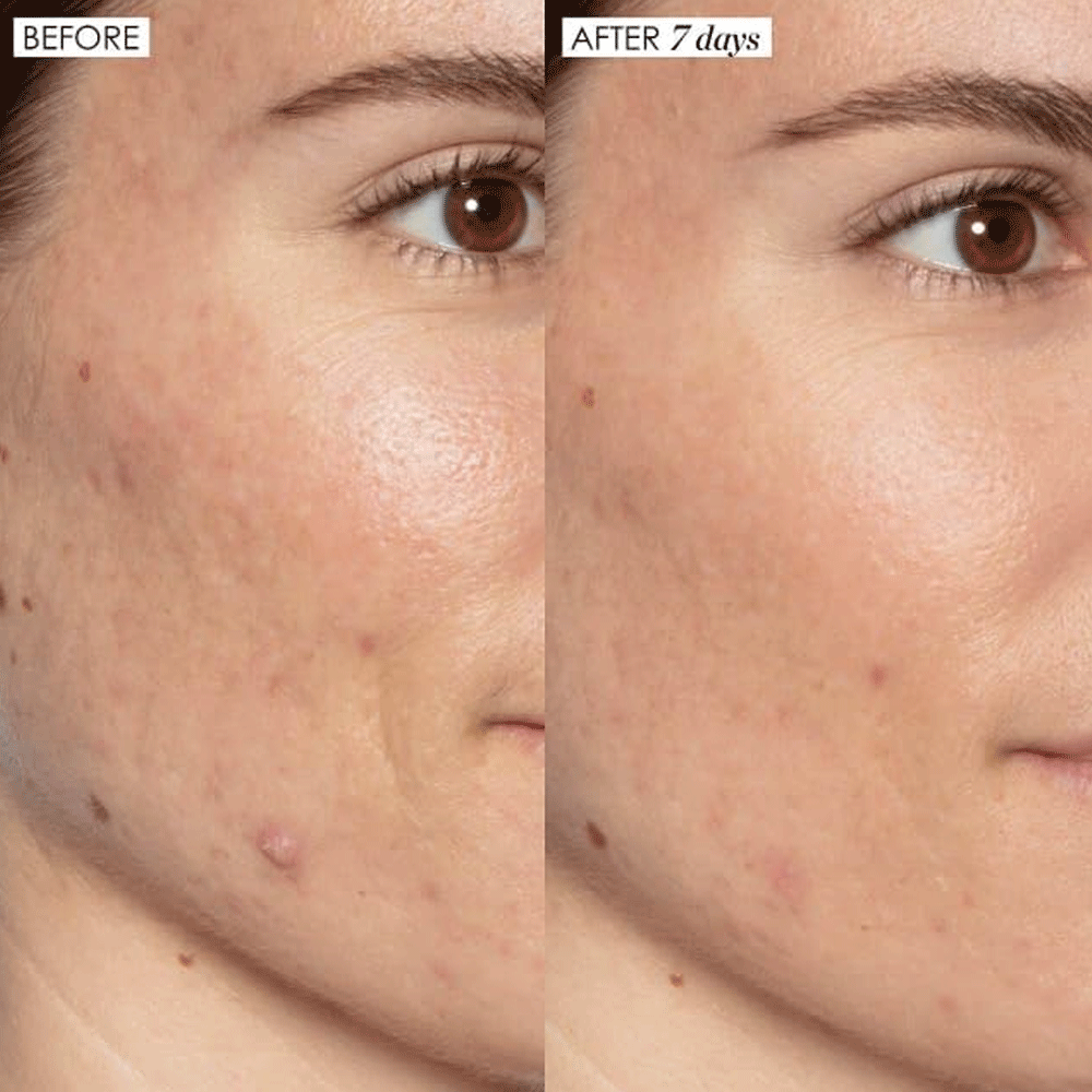 SUNDAY RILEY Good Genes Glycolic Acid Treatment 8ml