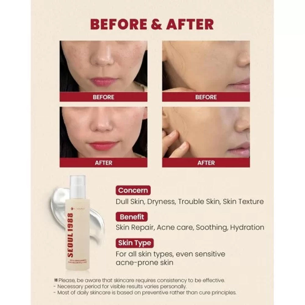 K-SECRET SEOUL 1988 ESSENCE : SNAIL MUCIN 97% + RICE -100ml