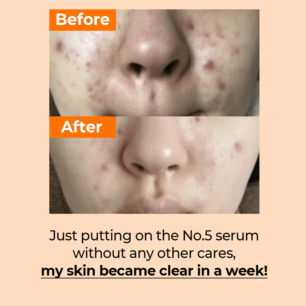 Numbuzin – No.5 Glutathione Vitamin Concentrated Serum 30ml